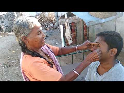 Amazing Technique To Remove "Dust And Stone From Eye" From Tamil Nadu