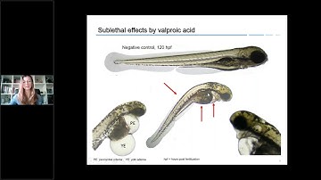 SaferWorldbyDesign Webinar: An alternative to mammalian teratogenicity tests?