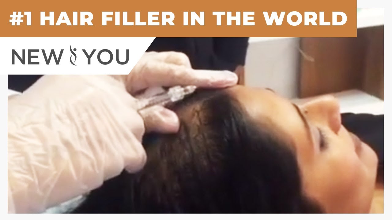 1 HAIR FILLER IN THE WORLD New You Med Spas YouTube