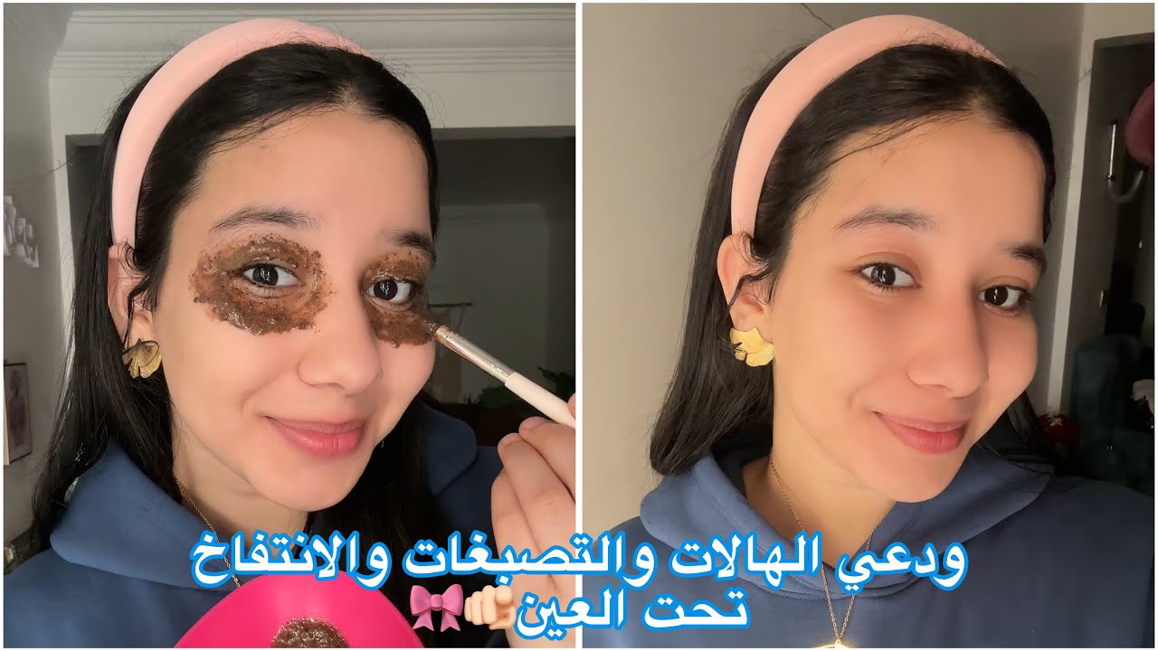أقوي ماسك للهالات السوداء والانتفاخ تحت العين بمكونين فقط🤩🎀 | تجهيزات العيد🎀