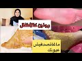 بملعقة ملح و نصف كوب من الخل ودعي و للأبد إسمرار و #تشققات_الرجلين من أول إستعمال