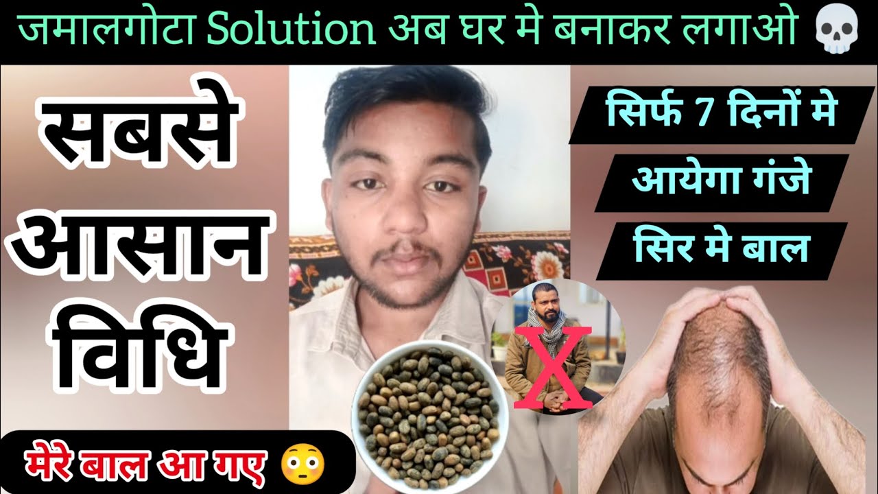 Jamalgota solution ab ghar me banakr lagao l💀✅l jamalgota hair treatment #jamalgotaforhairregrowth