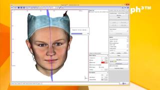 OnyxCeph³™ - Module Mirror_3D