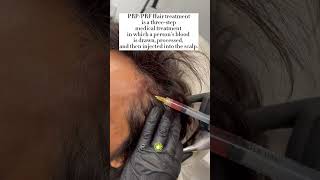 PRP/PRF Hair restoration