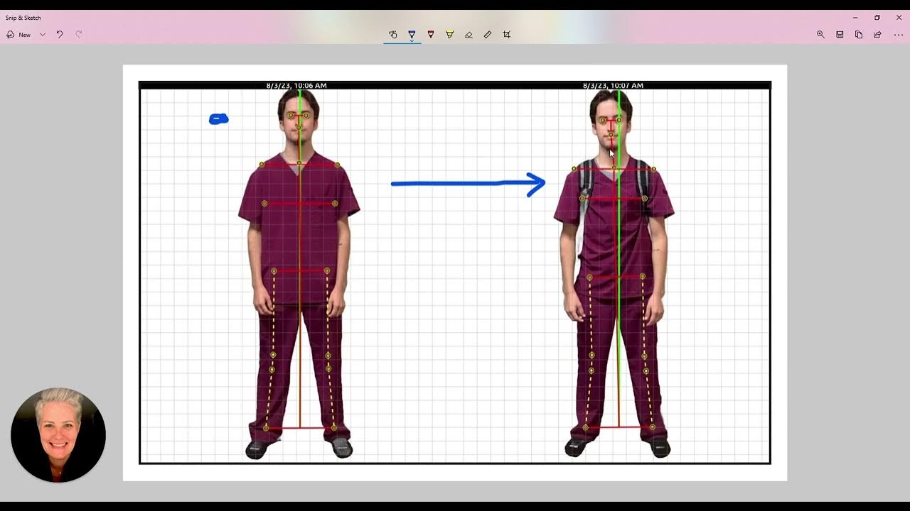 What are the Effects of Heavy Backpacks? YouTube