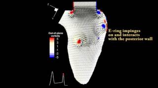 Vortex Formation and Instability in the Left Ventricle