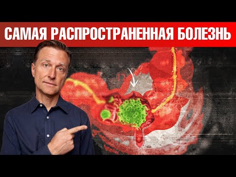 Эпидемия аутоиммунных заболеваний. Как себя обезопасить?🤔