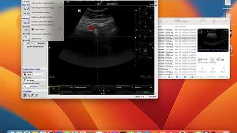 ITK-SNAP Tutorial: Drawing Segmentation Labels for Deep Learning or Medical Image Segmentation
