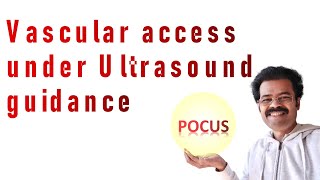 Ultrasound guided vascular access | IV access | IV cannulation