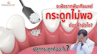 จะฝังรากเทียมแต่กระดูกไม่พอ ต้องทำยังไง? | ปลูกกระดูกคืออะไร? | รากฟันเทียม By Dentalimage