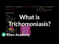 Trichomoniasis: Understanding, Diagnosis, and Treatment