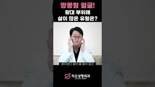 #shorts 땅콩형얼굴인데 광대에 살이 많다면?