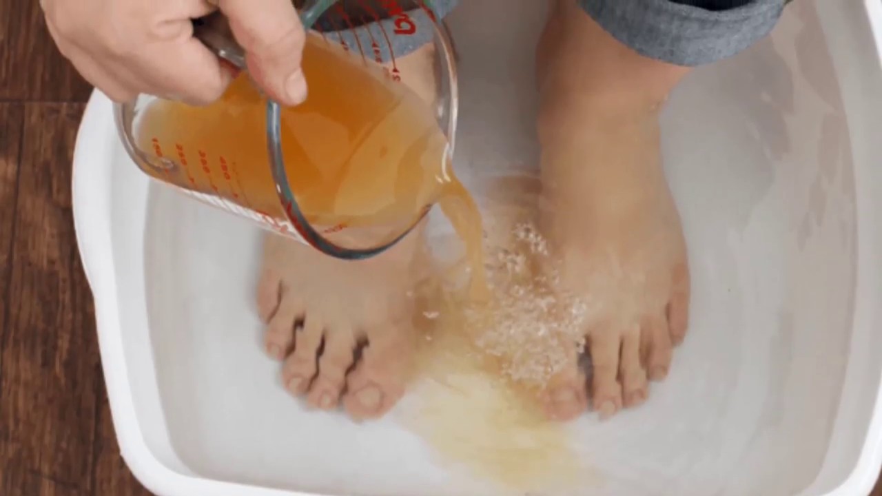 Ванночки сода йод. Грибок стопы ванночки для ног. Травяные ванночки для ног. Ванночки от грибка стопы.