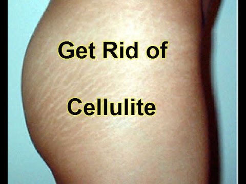 6 Tips How to Firm Thighs & Get Rid of Cellulite - YouTube