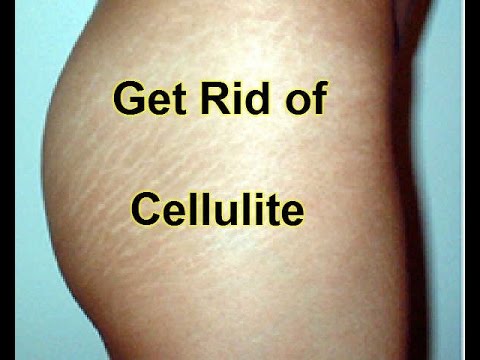 6 Tips How to Firm Thighs & Get Rid of Cellulite