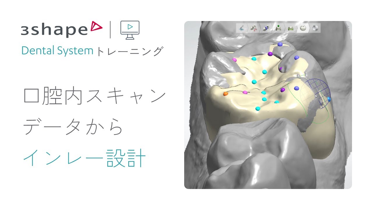 Dental Systemトレーニング - IOSデータからインレー設計