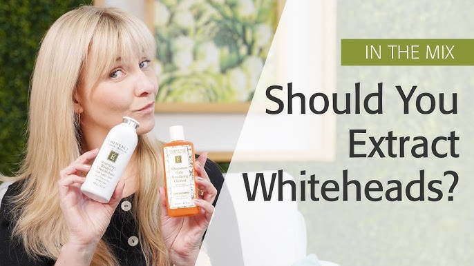 Eliminate Whiteheads Expert Advice For 2024
