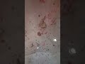 This tenant is dealing with mould, flooding in her public housing unit