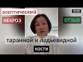 Асептический некроз таранной и ладьевидной кости голеностопного сустава. Успехи восстановления.Ч.1