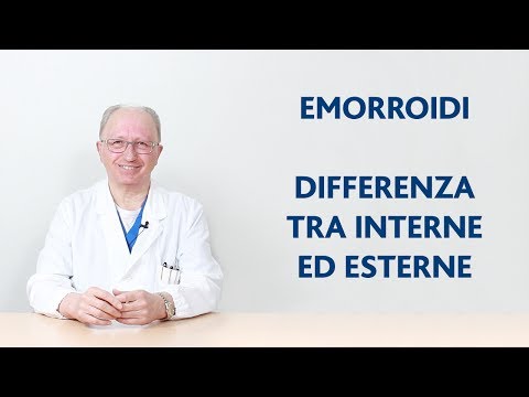 Video: Differenza Tra Ernia Ed Emorroidi