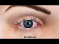 眼乾後果嚴重, 嶄新LipiFlow Vector Thermal Pulse (VTP) 技術從根本擊退乾眼症!