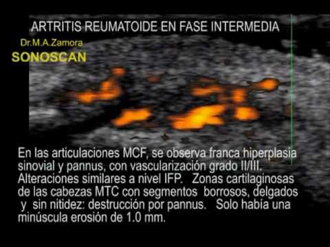 camera iphone 8 plus apk AR FASE INTERMEDIA.