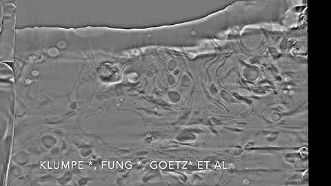 SerialFIB FIB-SEM Tomography on C. rheinhardtii cells