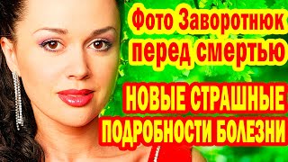 НОВЫЕ СТРАШНЫЕ Подробности Болезни, Профессор о ПОСЛЕДНИХ МИНУТАХ Жизни- ФОТО Анастасии Заворотнюк