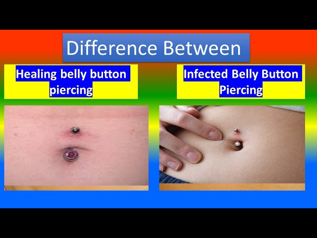 Distinction between Healing belly button piercing and Infected Belly Button  Piercing - YouTube
