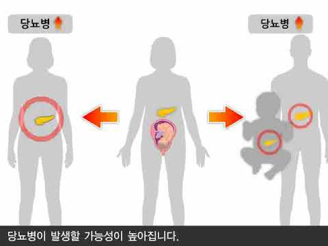 임신성 당뇨병의 개념