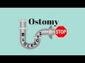 Dealing With Ostomy Blockages: Ostomy Tips