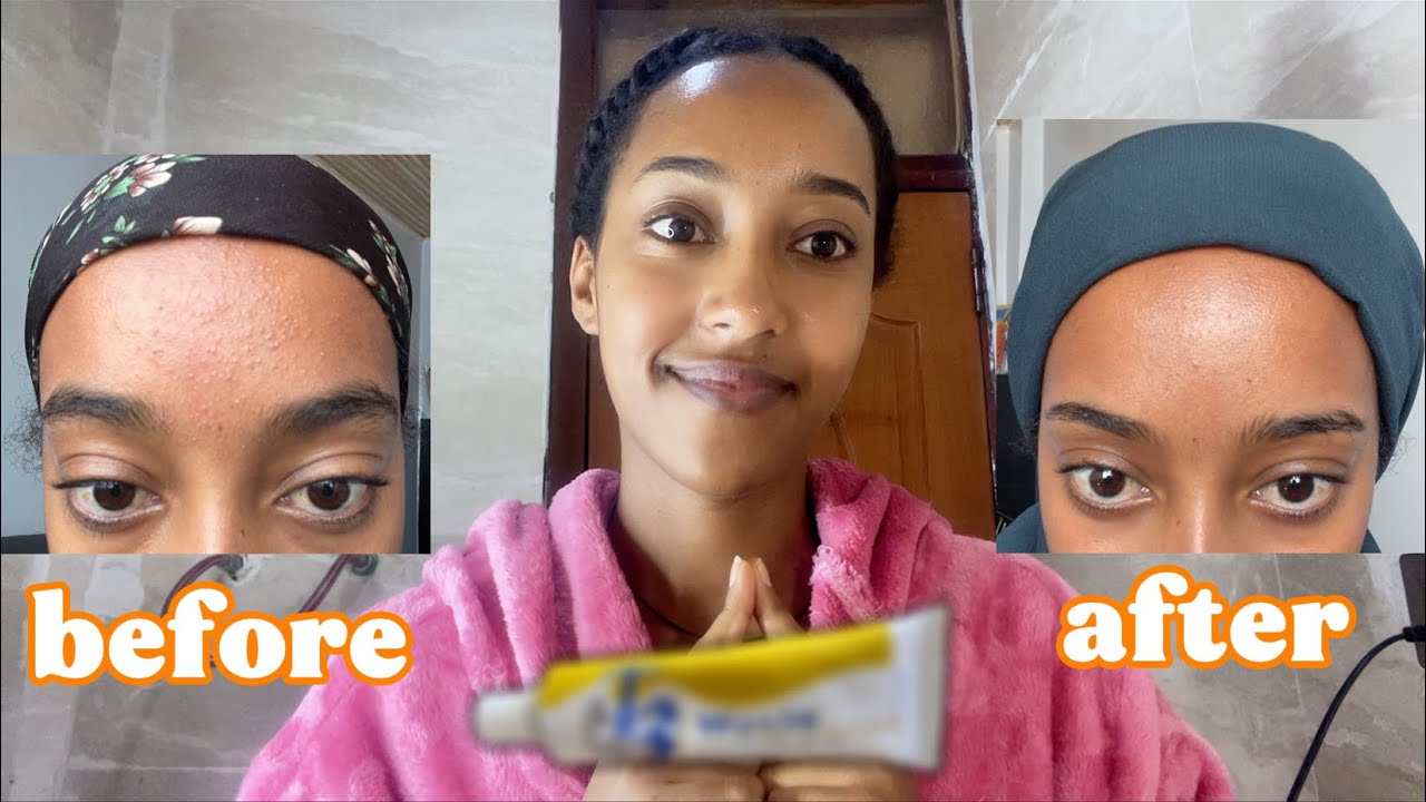 My skin care routine