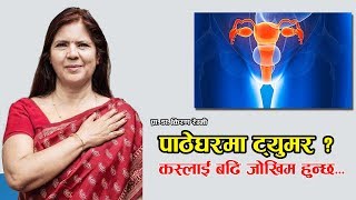 कसलाई हुनसक्छ पाठेघरमा ट्युमर ? | Nepali Health Tips | Doctor Saathi