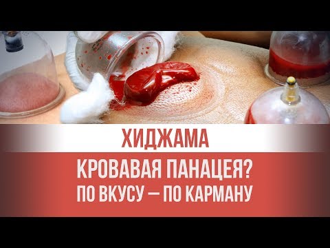 Хиджама: Омолаживание или бизнес на крови? По вкусу – по карману