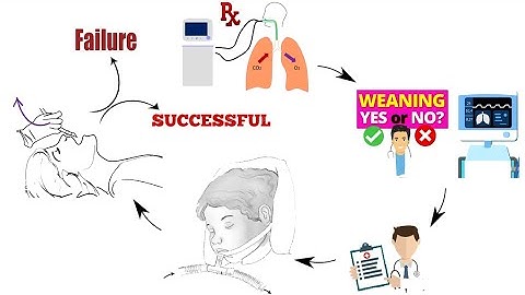 PoCUS in weaning_Dr Pradeep Rangappa