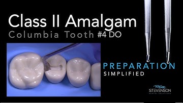 Amalgam Simplified Preparation - Columbia #4 DO | Two Burs Only