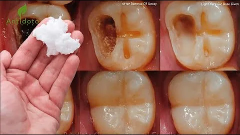 ¿Qué pastas dentales dañan la salud?