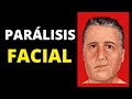 Parálisis facial: síntomas, diagnóstico, tratamiento y pronóstico