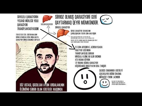 Aydin Xirdalanlinin ölumune sebeb olan diaqnoz haqqinda / Medplus TV