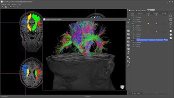 BrainMagix 2.1: Constrained spherical deconvolution-based tractography