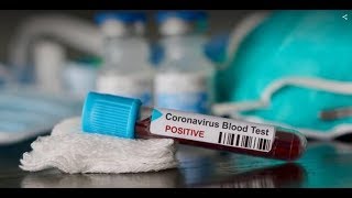 Coronavirus Ecco Cos&#39;è