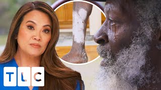 Man Visits Dr Lee With The Worst Case Of Psoriasis That She’s Ever Seen | Dr. Pimple Popper
