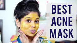 BEST ACNE MASK│CURD + TURMERIC MASK│PAYAL SINGH, How To Get Fair,Glowing,Pimplefree Skin:Home Remedy For Clear & Wrinklefree Skin, DIY Face Mask for Clear, Glowing Skin! Turmeric, Yogurt & Lemon!, Curd And turmeric face mask | tania pal, Tumeric and Yogurt Facemask Recipe For Amazing Skin