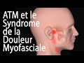 Latm et le syndrome de la douleur myofasciale animation