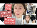 My Coil Experience - LOST MIRENA COIL, OVERDUE SMEAR, POSITIVE HPV TEST - UK