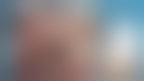 OmniGuide System Modes of Operation for Neurosurgery