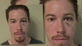 Shaun White Arrested | Splash News TV | Splash News TV