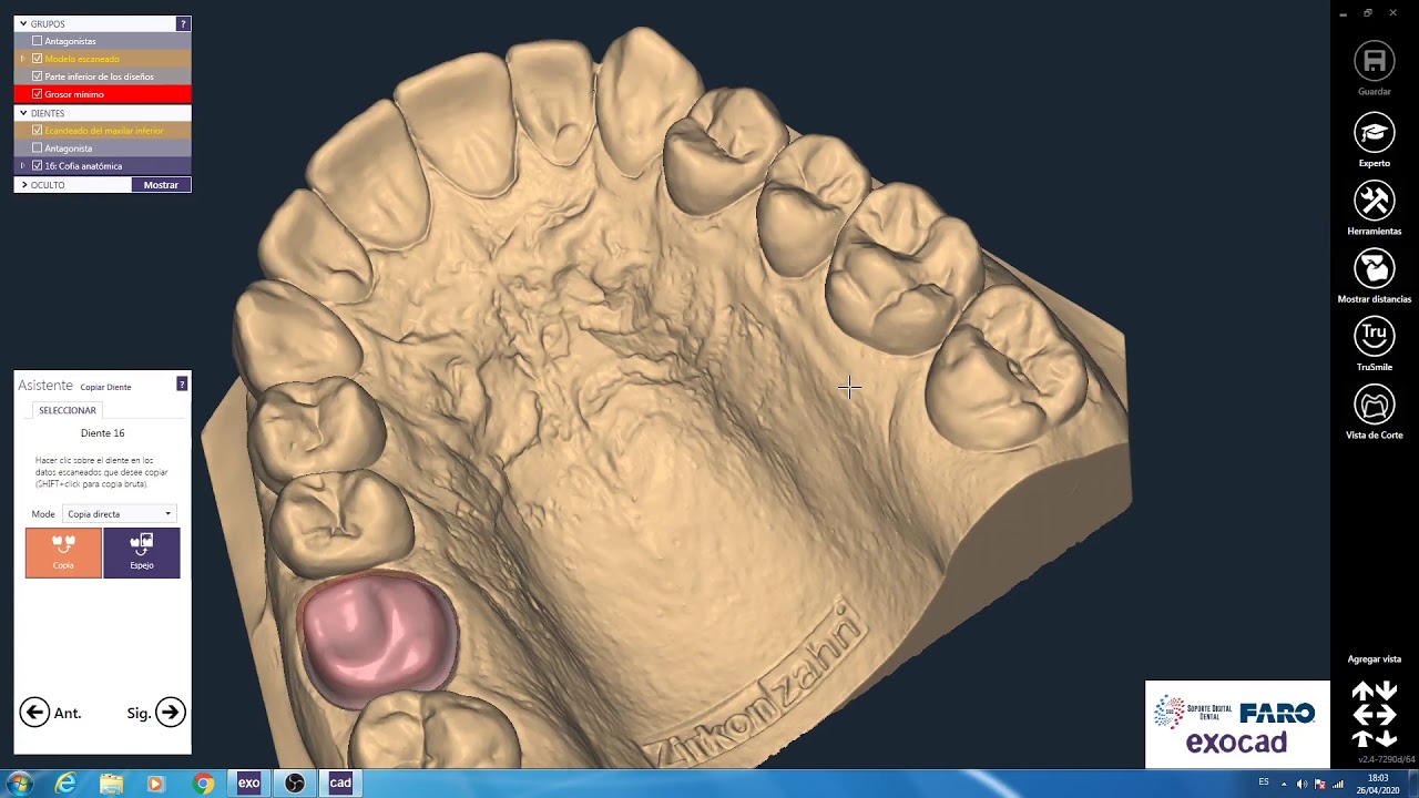 Exocad Dental Cad cofia anatómica 16
