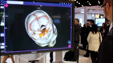 Siemens @ RSNA2011: Hands-free Navigation Through Radiological Images (with Microsoft Kinect )