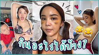 ใครเคยกิน ตำปูปลาร้า หลังศัลย์เสร็จบ้าง? | Yae uunws